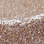 Immunohistochemical staining of human cerebellum shows strong cytoplasmic positivity in cells in granular layer.