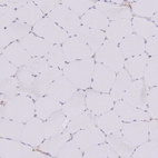 Immunohistochemical staining of human skeletal muscle shows no positivity in myocytes as expected.
