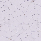 Immunohistochemical staining of human skeletal muscle shows no positivity in myocytes as expected.
