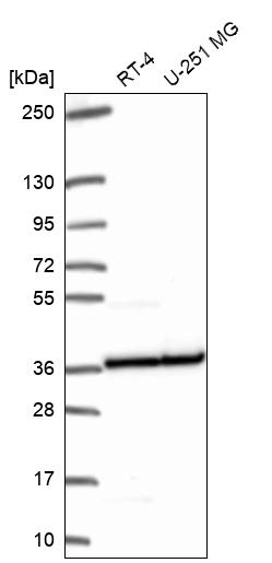 Anti-RPL5 Antibody