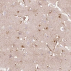 Anti-DHX35 Antibody