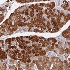 Anti-IRAK1 Antibody