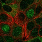 Immunofluorescent staining of human cell line MCF7 shows localization to nucleus & cytosol.