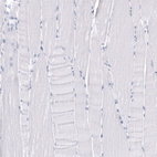 Immunohistochemical staining of human skeletal muscle shows no positivity in myocytes as expected.