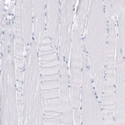 Immunohistochemical staining of human skeletal muscle shows no positivity in myocytes as expected.