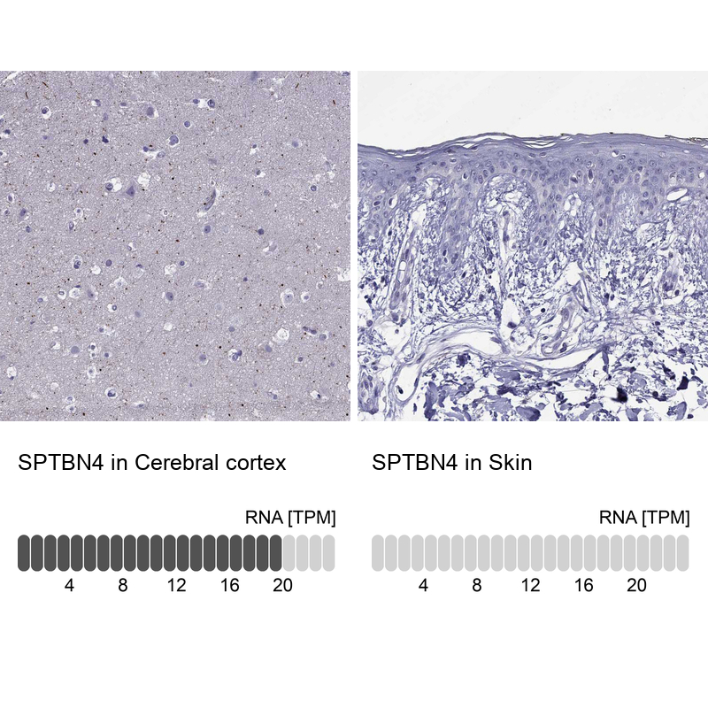 Anti-SPTBN4 Antibody