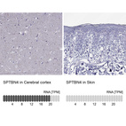 Anti-SPTBN4 Antibody