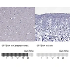 Anti-SPTBN4 Antibody