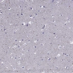 Immunohistochemical staining of human cerebral cortex shows weak to moderate cytoplasmic positivity in neurons.