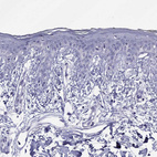 Immunohistochemical staining of human skin shows no positivity in keratinocytes as expected.