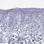 Immunohistochemical staining of human skin shows no positivity in keratinocytes as expected.