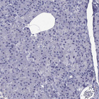Immunohistochemical staining of human pancreas shows no positivity in exocrine glandular cells as expected.