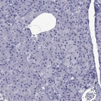 Immunohistochemical staining of human pancreas shows no positivity in exocrine glandular cells as expected.