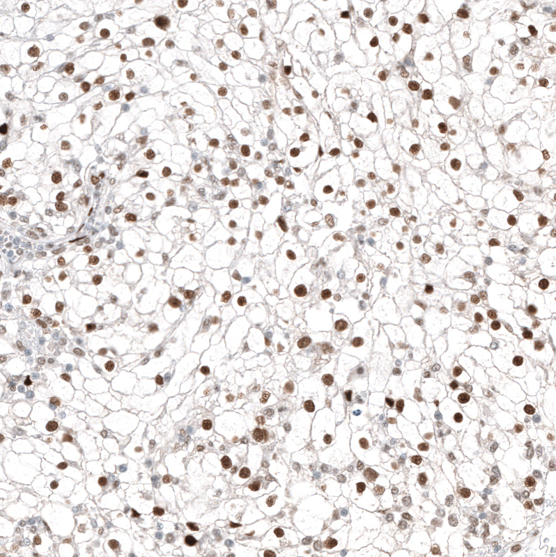Anti-TFE3 Antibody