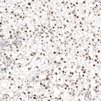 Anti-TFE3 Antibody