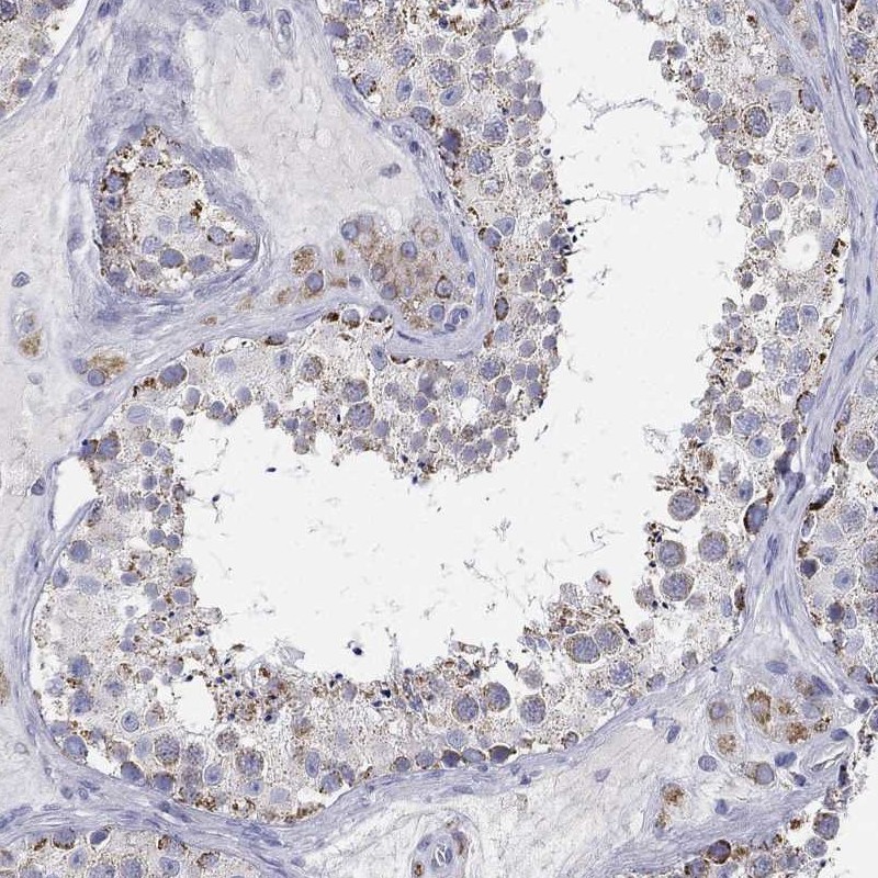 Anti-PWWP3A Antibody