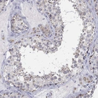 Anti-PWWP3A Antibody