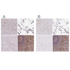 Immunohistochemical staining of human liver, lung, skeletal muscle and spleen using Anti-PYCARD antibody HPA054496 (A) shows similar protein distribution across tissues to independent antibody HPA049074 (B).