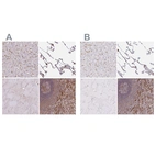 Immunohistochemical staining of human liver, lung, skeletal muscle and spleen using Anti-PYCARD antibody HPA054496 (A) shows similar protein distribution across tissues to independent antibody HPA049074 (B).