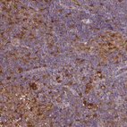 Immunohistochemical staining of human lymphoid tissues shows moderate cytoplasmic positivity in non-germinal center cells.