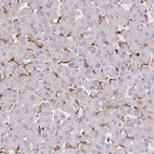 Immunohistochemical staining of human liver shows moderate cytoplasmic positivity in Kupffer cells.