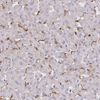 Immunohistochemical staining of human liver shows moderate cytoplasmic positivity in Kupffer cells.