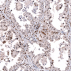 Anti-TFE3 Antibody