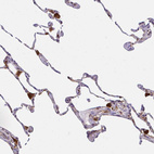 Immunohistochemical staining of human lung shows moderate cytoplasmic positivity in macrophages.