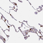 Immunohistochemical staining of human lung shows moderate cytoplasmic positivity in macrophages.