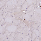 Immunohistochemical staining of human skeletal muscle shows low positivity in myocytes as expected.