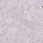 Immunohistochemical staining of human skeletal muscle shows low positivity in myocytes as expected.