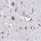 Anti-RPS15 Antibody