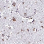 Immunohistochemical staining of human cerebral cortex using Anti-RPS15 antibody HPA054510.