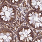 Immunohistochemical staining of human colon using Anti-RPS15 antibody HPA054510.