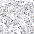 Anti-TFE3 Antibody