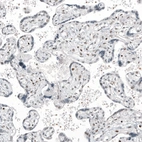 Immunohistochemical staining of human placenta shows moderate nuclear positivity in trophoblastic cells.