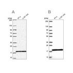 Anti-RPS15 Antibody