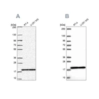 Western blot analysis using Anti-RPS15 antibody HPA054510 (A) shows similar pattern to independent antibody HPA057793 (B).