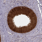 Anti-GSS Antibody