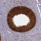 Immunohistochemical staining of human epididymis shows strong cytoplasmic and membranous positivity in glandular cells.