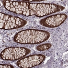 Immunohistochemical staining of human rectum shows strong cytoplasmic and membranous positivity in glandular cells.