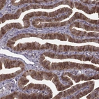 Immunohistochemical staining of human fallopian tube shows strong cytoplasmic and membranous positivity in glandular cells.