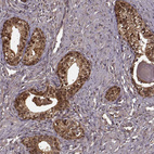 Anti-GSS Antibody