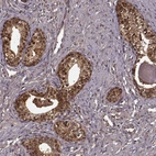 Immunohistochemical staining of human prostate shows strong cytoplasmic and membranous positivity in glandular cells.
