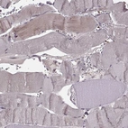 Immunohistochemical staining of human skeletal muscle shows very weak cytoplasmic positivity in myocytes.