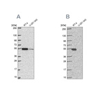 Anti-GSS Antibody