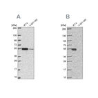 Western blot analysis using Anti-GSS antibody HPA054508 (A) shows similar pattern to independent antibody HPA059315 (B).
