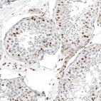 Anti-TFE3 Antibody