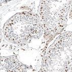 Immunohistochemical staining of human testis shows moderate nuclear positivity in cells in seminiferous ducts.