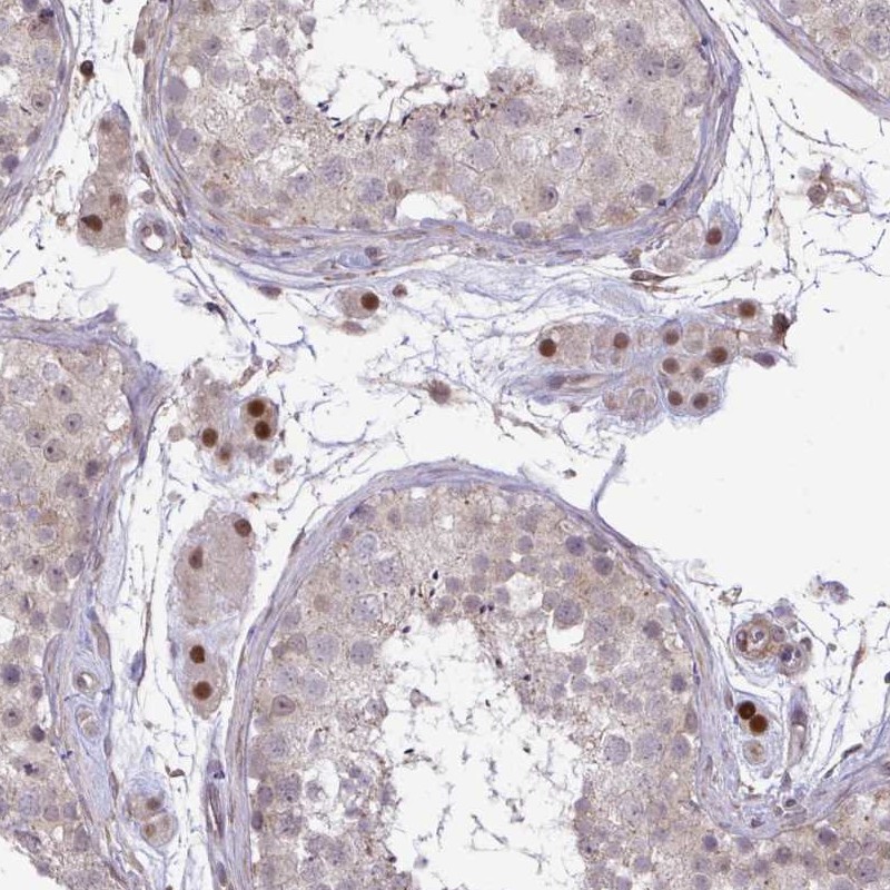 Anti-ZSCAN9 Antibody